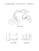 MINIMALLY INVASIVE DETERMINATION OF COLLATERAL VENTILATION IN LUNGS diagram and image