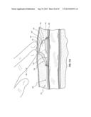 SUBCUTANEOUS VASCULAR ACCESS PORTS diagram and image