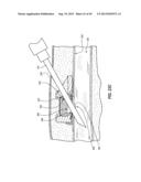 SUBCUTANEOUS VASCULAR ACCESS PORTS diagram and image