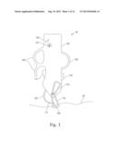 MEANS AND METHODS FOR SUTURING TISSUE diagram and image