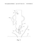 MEANS AND METHODS FOR SUTURING TISSUE diagram and image