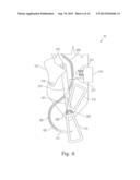 MEANS AND METHODS FOR SUTURING TISSUE diagram and image