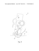 MEANS AND METHODS FOR SUTURING TISSUE diagram and image