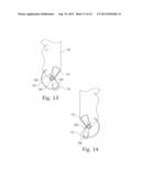 MEANS AND METHODS FOR SUTURING TISSUE diagram and image