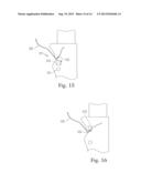 MEANS AND METHODS FOR SUTURING TISSUE diagram and image