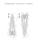 Narrow Profile Surgical Ligation Clip diagram and image