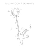 EXTRALUMINAL SEALANT APPLICATOR AND METHOD diagram and image