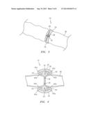 EXTRALUMINAL SEALANT APPLICATOR AND METHOD diagram and image