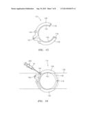 EXTRALUMINAL SEALANT APPLICATOR AND METHOD diagram and image