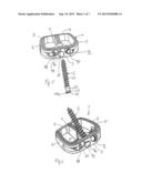 IMPLANT FOR STABILIZING BONES OR VERTEBRAE diagram and image