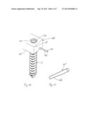 IMPLANT FOR STABILIZING BONES OR VERTEBRAE diagram and image