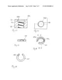 IMPLANT FOR STABILIZING BONES OR VERTEBRAE diagram and image