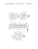 DYNAMIC BONE FIXATION ELEMENT diagram and image