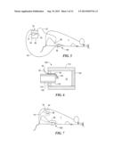 SLEEVE FOR STIMULATION OF TISSUE REGENERATION diagram and image