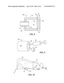 SLEEVE FOR STIMULATION OF TISSUE REGENERATION diagram and image