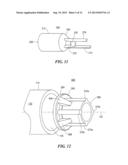 SLEEVE FOR STIMULATION OF TISSUE REGENERATION diagram and image