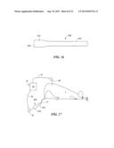 SLEEVE FOR STIMULATION OF TISSUE REGENERATION diagram and image