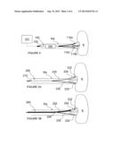 Methods and Apparatus for Multi-Vessel Renal Neuromodulation diagram and image