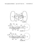 Methods and Apparatus for Multi-Vessel Renal Neuromodulation diagram and image