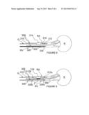 Methods and Apparatus for Multi-Vessel Renal Neuromodulation diagram and image