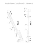 Method And Apparatus For Tibial Fixation Of An ACL Graft diagram and image