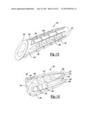 Method And Apparatus For Tibial Fixation Of An ACL Graft diagram and image