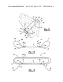 Method And Apparatus For Tibial Fixation Of An ACL Graft diagram and image