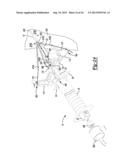 Method And Apparatus For Tibial Fixation Of An ACL Graft diagram and image