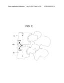 INTERBODY VERTEBRAL PROSTHETIC AND ORTHOPEDIC FUSION DEVICE WITH     SELF-DEPLOYING ANCHORS diagram and image