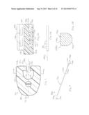 MODULAR SEGMENTED DISC NUCLEUS IMPLANT diagram and image