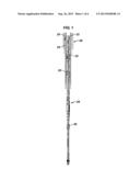 RETRIEVABLE CEMENTING BUSHING SYSTEM diagram and image