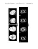 MRI DATA ACQUISITION, RECONSTRUCTION AND CORRECTION METHODS FOR DIFFUSION     WEIGHTED IMAGING (DWI) AND DIFFUSION TENSOR IMAGING (DTI) AND RELATED     SYSTEMS diagram and image
