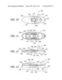 REMOTE CONTROLS AND AMBULATORY MEDICAL SYSTEMS INCLUDING THE SAME diagram and image