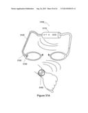 Eyewear Including A Remote Control Camera diagram and image