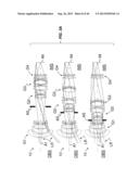 Zoom lens with forward-located aperture stop diagram and image