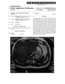 Motion Compensated MR Imaging System diagram and image