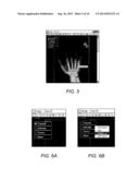 METHOD FOR CREATING A REPORT FROM RADIOLOGICAL IMAGES USING ELECTRONIC     REPORT TEMPLATES diagram and image