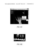 METHOD FOR CREATING A REPORT FROM RADIOLOGICAL IMAGES USING ELECTRONIC     REPORT TEMPLATES diagram and image