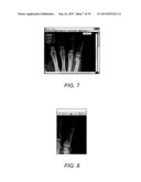 METHOD FOR CREATING A REPORT FROM RADIOLOGICAL IMAGES USING ELECTRONIC     REPORT TEMPLATES diagram and image