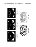 Functionalized Magnetic Nanoparticles and Methods of Use Thereof diagram and image