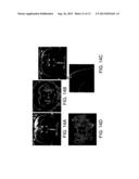 Functionalized Magnetic Nanoparticles and Methods of Use Thereof diagram and image