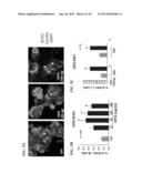 USE OF OSTEOPROTEGERIN (OPG) TO INCREASE HUMAN PANCREATIC BETA CELL     SURVIVAL AND PROLIFERATION diagram and image