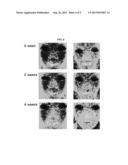 COSMETIC COMPOSITION FOR SKIN MOISTURISATION COMPRISING PINE-RESIN     EXTRACT, PINUS DENSIFLORA NEEDLE EXTRACT AND PINUS DENSIFLORA ROOT     EXTRACT diagram and image