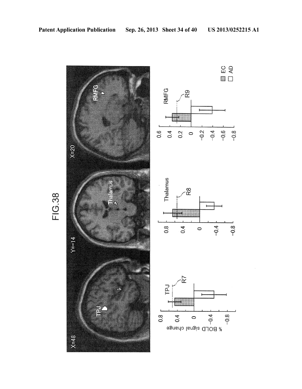 METHOD AND DEVICE FOR VERIFYING ONSET OF DEMENTIA - diagram, schematic, and image 35