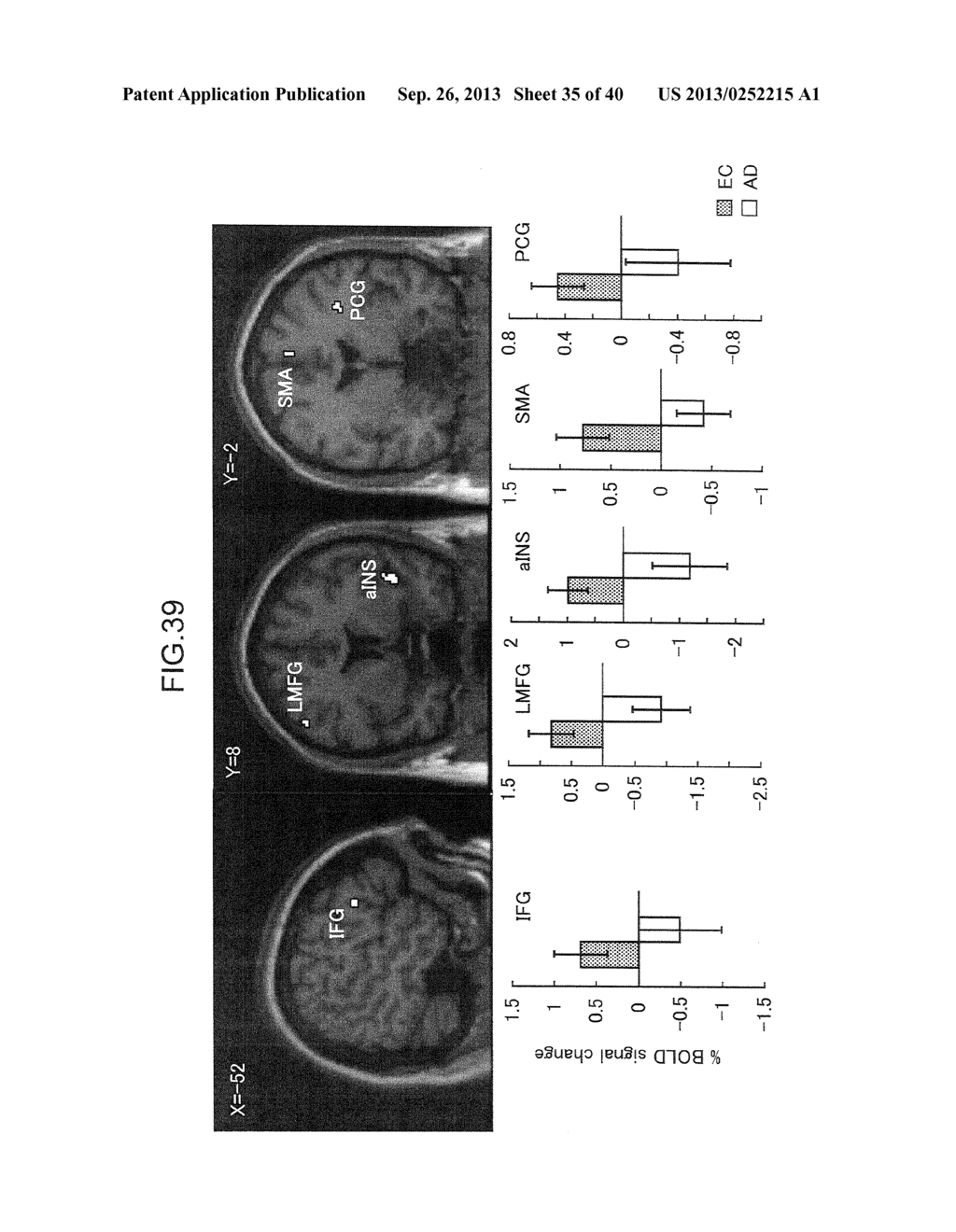 METHOD AND DEVICE FOR VERIFYING ONSET OF DEMENTIA - diagram, schematic, and image 36