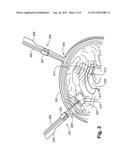 GUIDE FOR PLACEMENT OF CATHETER INTO BRAIN AND A METHOD OF UTILIZING THE     SAME diagram and image