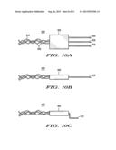 SINGLE AND MULTI-NEEDLE ELECTROMYOGRAPHIC (EMG) RECORDING ELECTRODE     CONFIGURATIONS FOR INTRAOPERATIVE NERVE INTEGRITY MONITORING diagram and image