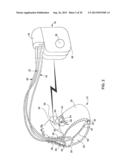 IMPLANTABLE MEDICAL DEVICE DEPLOYMENT WITHIN A VESSEL diagram and image