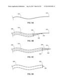 IMPLANTABLE MEDICAL DEVICE DEPLOYMENT WITHIN A VESSEL diagram and image