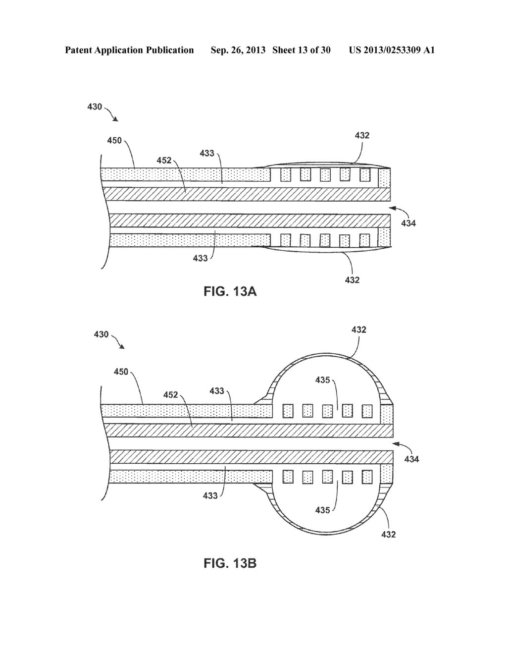 IMPLANTABLE MEDICAL DEVICE DEPLOYMENT WITHIN A VESSEL - diagram, schematic, and image 14